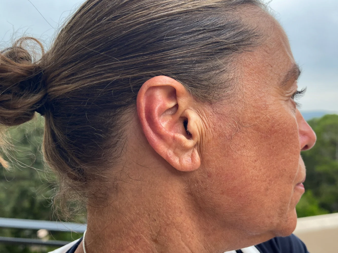 Ohr im Profil ohne Schmuck und ohne sichtbares Hörgerät (Symbolbild)
